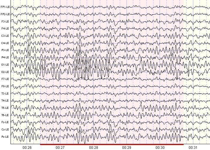 Brainwaves