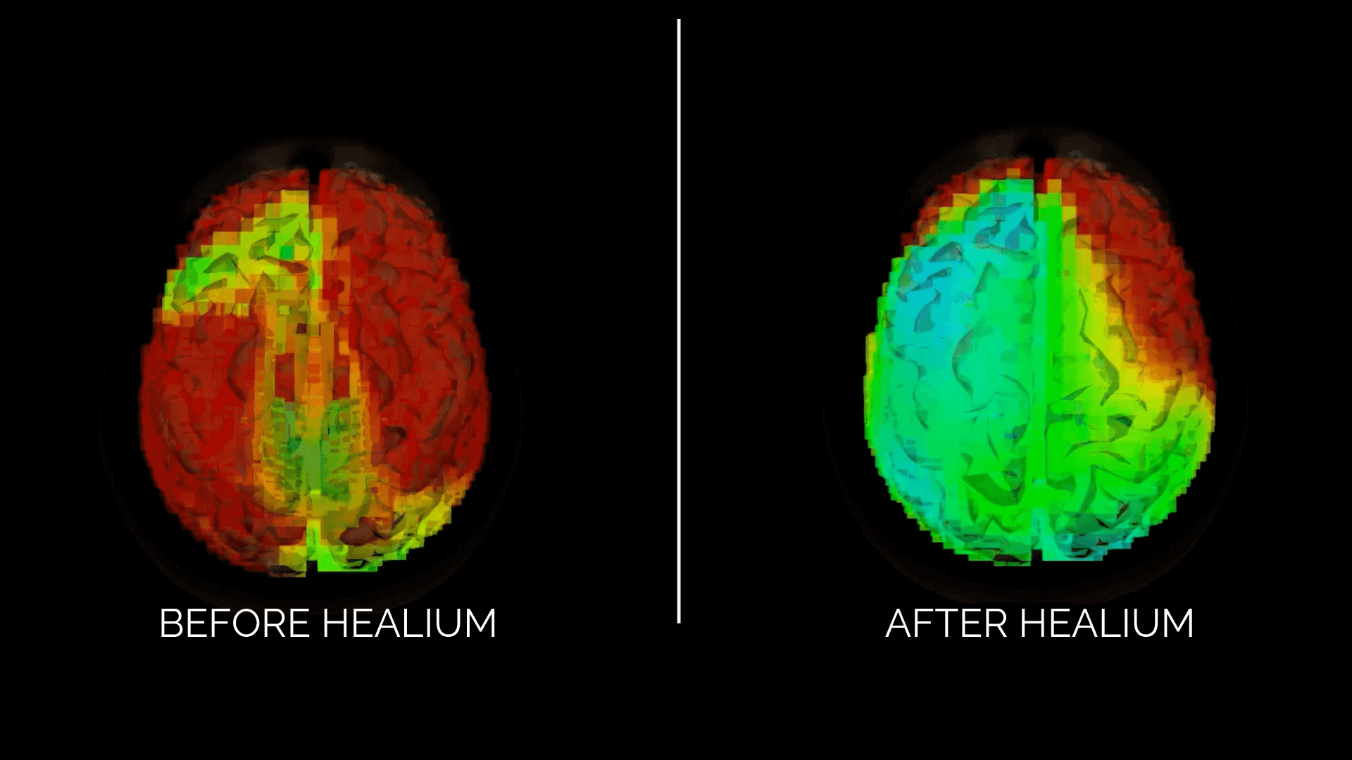 BEFORE BRAIN HEALIUM