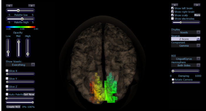 Internal Talk left insula