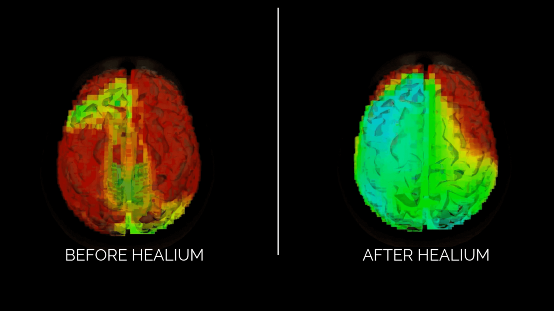 healium brain