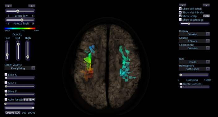 Left parahippocampal Gyus